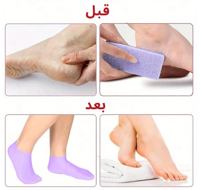 جوارب السيليكون المرطبة للعناية بالقدمين وعلاج التشققات - تدليك وعناية فائقة للأقدام الجافة